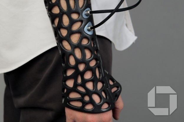 Nýtækni, þrívíddar gips á beinbrotin